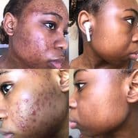 TikTok Account - essentialbeautyexperts