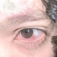 TikTok Account - munibakihunyar