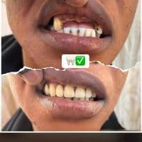 TikTok Account - le.dentiste0