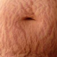 TikTok Account - etrechisansvergeture